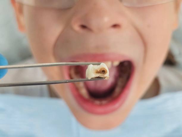 Best Weekend Emergency Dentist in Blue Grass, IA