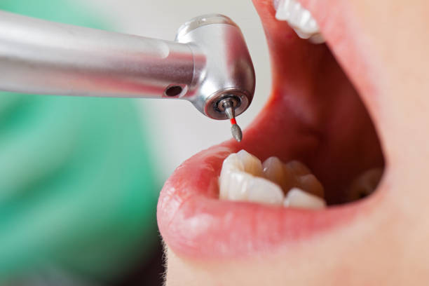 Best Emergency Treatment for Dental Infections or Abscesses in Blue Grass, IA